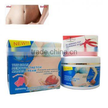 Aichun Beauty 300g Snail Remove Stretch Marks Scar Removal Cream + 40g Slimming Fat Buring Soap