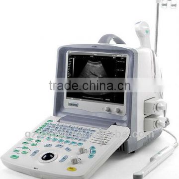 365 Frames Bidirectional Cine-loop Portable Ultrasound for Pregnancy