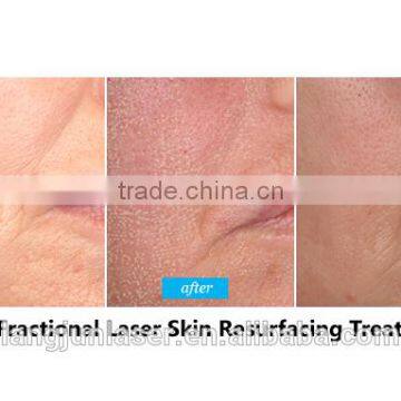 High Power 50w Co2 Laser Engraving and Cutting Machine photo-2