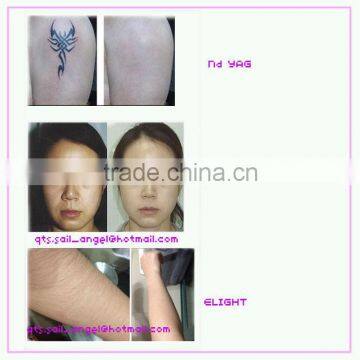Attention!!! Vertical Elight + Nd Yag Shr Facial Veins Treatment Ipl Rf +nd Yag Q Switched Laser Machine 800mj photo-4