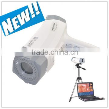 New portable digital Electronic Colposcope with CCD Sony Camera 800,000 pixels with Analysis software RCS-400 model manufacture