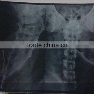 medical x ray film, x ray film china of printing consumables