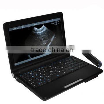 10 Inch Laptop Veterinary Ultrasound Scanner Vet Convex Probe Rectal Probe Optional photo-4