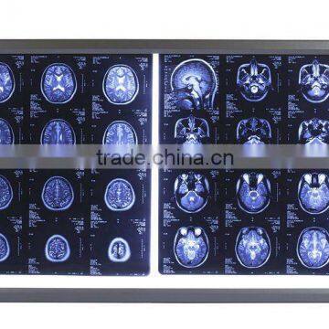 high brightness ultra slim x-ray film viewer