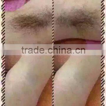 Fast Med Shr Ipl Laser Hair Removal/ Skin Rejuvenation Shr Ipl Elight Machine With CE for Sale photo-6