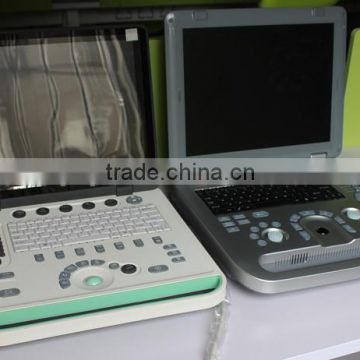 Ultrasound scanner, Ultrasound machine for pregnancy with portable ultrasound scanner MSLPU25W