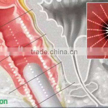Vaginal Tightening Device Ultrasonic Focusing Technique With Hifu Vagina Treatment photo-6