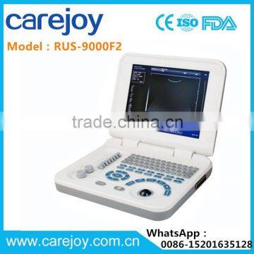 Full Digital Laptop B&W ultrasound system Ultrasound Scanner Ultrasound machine