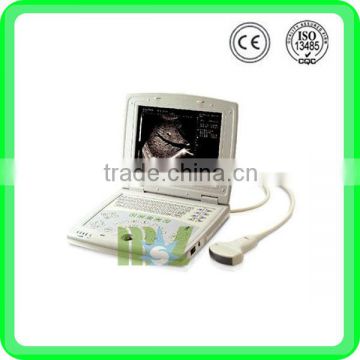 MSLTU07 laptop full digital ultrasound scanner