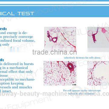 HIFUShape Body Contouring/HIFU Body Shaping/HIFU Fat Reduction System photo-2