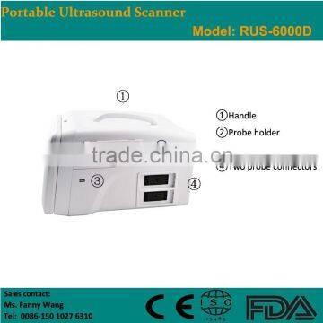 CE Approved Portable B-Mode Ultrasonic/ Ultrasound Scanner With 3.5Mhz Multi-frequency Convex Probe RUS-6000D photo-3
