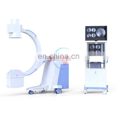 HC-D009B Quality high frequency mobile x-ray 5KW C-arm x-ray machine