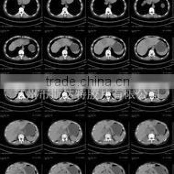 medical dry laser x-ray film thermal film for scanning system