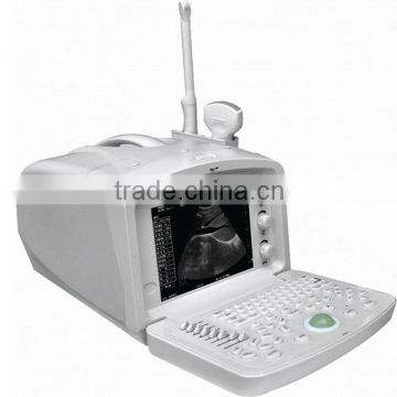 2014 Hot Sale Portable Digital Ultrasound FM-9001A