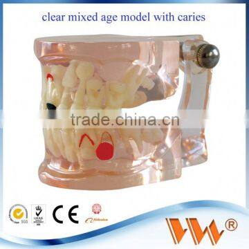 child pathological teeth model 3d dimensions jewelry dental model