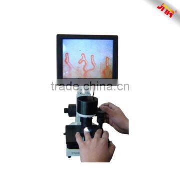 Medical human blood capillary microcirculation testing microscope