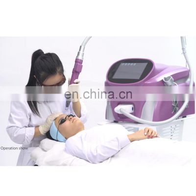 2021 Hot tattoo pigment removal laser machine for tattoo removal nd yag laser machine