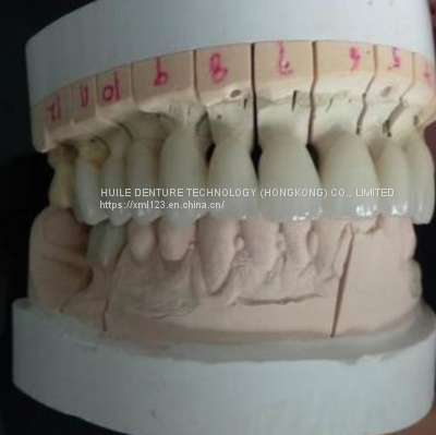 Semi-Precious Dental Lab, Dental Lab China