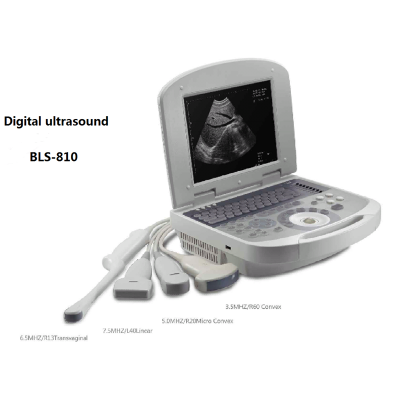All Digital Ultrasonic Diagnosis SystemPortable Digital Acoustic Diagnostic Scanner for Human in Hospital photo-4