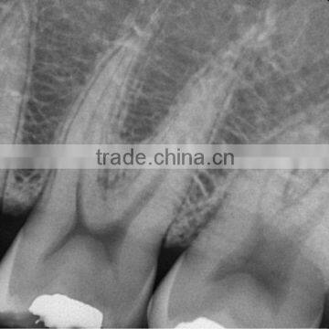 Rex2 Premium Sensor photo-2