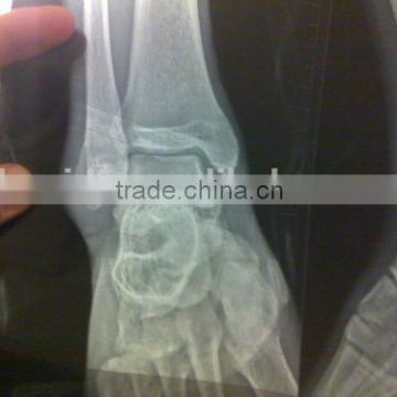 x ray film china, x-ray image of equipment accessories