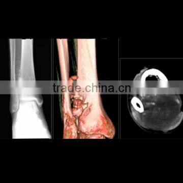 Real human x ray medical image radiology bone film