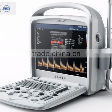 cheap price portable color doppler ultrasound diagnostic system