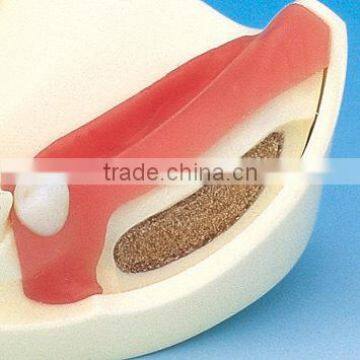 Typodont Orthodontic Model for Practicing Teeth Model Factory photo-6