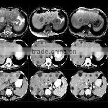 X-ray Film Chemical Medical Polyurethane Film A4