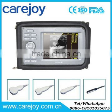 Carejoy Handheld Ultrasound Scanner HandScan H8 with 3.5 Mhz Convex probe suitable carry/transporation good price