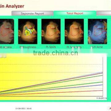 Skin Tester Professional Magic Mirror Skin Analyzer Skin Diagnostic Equipment