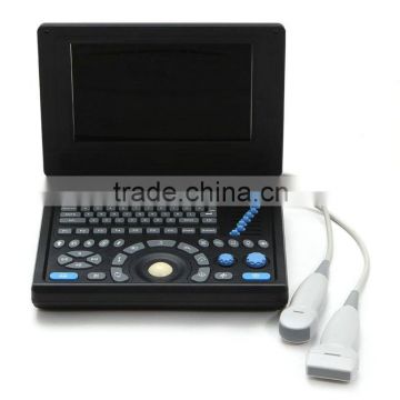 2016 CE&ISO Best Price of Portable/Notebook/Laptop ultrasound Scanner/machine with convex, linear, vaginal, rectal transducer