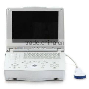 15-inch Laptop Ultrasound Scanner With Multi-frequency Probes photo-2