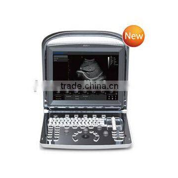 Promotion!!CE approved Notebook/ Portable Chison USB Ultrasound Scanner with 3.5Mhz multi-frequency convex probe ECO1