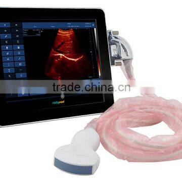 9.7 Inch Touchscreen Full Digital UpadScan Ultrasound Scanner With CE Approved photo-2