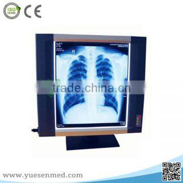 YSX1704 Hospital radiographic medical LED single x-ray film viewer