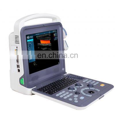 Portable Color Doppler Medical Ultrasound Instruments