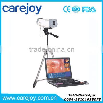 CE Approved Electronic Colposcope RCS-400 color digital with CCD Sony Camera for Vaginalitis, cervical ectropio, cervicitis