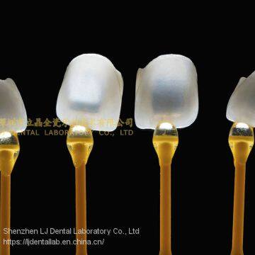 Ultra-thin Dental Veneers, Porcelain Veneer, Dental Laminates, Laboratoire Dentaire, Dentallabor, Laboratorio Dental, Dental Laboratory, Shenzhen LJ Dental Lab China