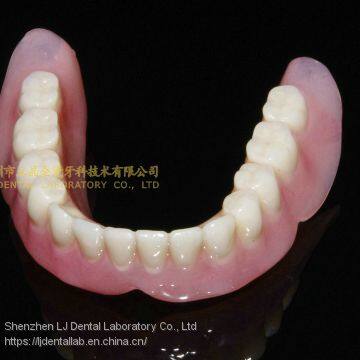 Dental Partial Acrylic Denture, Complete Denture, Full Dental Dentures, Laboratoire Dentaire, Dentallabor, Laboratorio Dental, Dental Laboratory, Shenzhen LJ Dental Lab China photo-2
