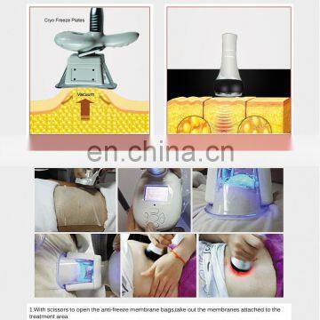 Popular Fat Freezing /cryolipolysis Slimming Machine/criolipolisys Machine photo-2
