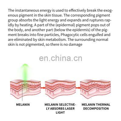 Q Switch ND Yag Laser Machine Non Invasive Tattoo Removal Laser Machine Freckle Eyebrow Pigment Removal Beauty Instrument photo-5