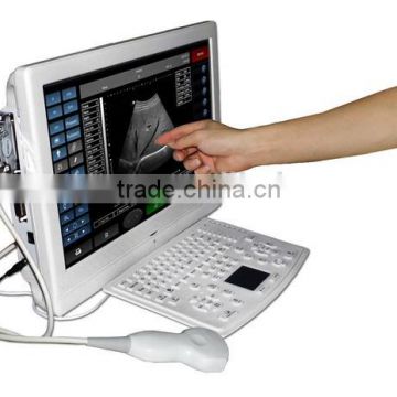 3D Portable ultrasound scanner machinie with touch screen