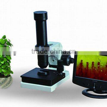 Nail fold Microcirculation Microscope