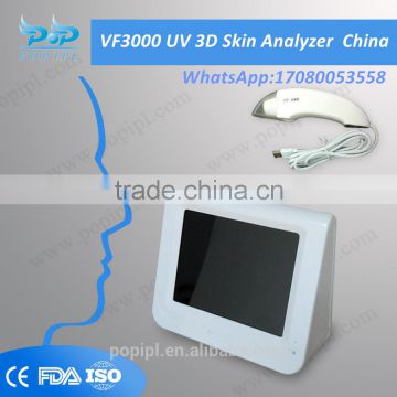 VF5000 China UV Skin Analyzer factory manufacturers supplier CE approval VF5000