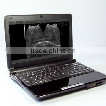 Portable Full Digital Berry ultrasound machine with Convex Probe made in China