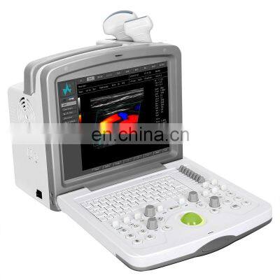 MKR6000 Full Digital Color Doppler Diagnostic System ultrasound