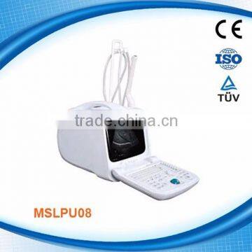 MSLPU08 portable medical ultrasonic scanner