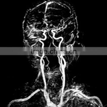 dental digital x-ray film