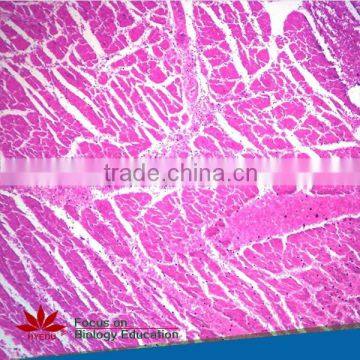Individual slides you can choose from Human pathology tissue microscope prepared slides